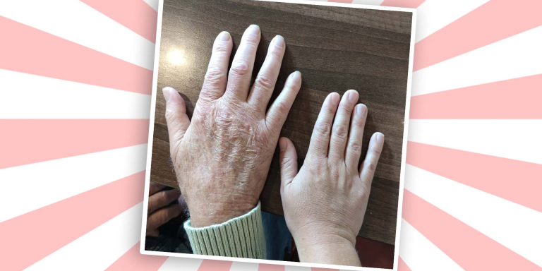 Zeeuwse Zuster - handen